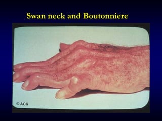 Swan neck and Boutonniere
 