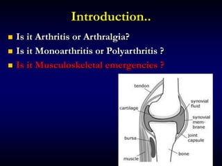 Introduction..
 Is it Arthritis or Arthralgia?
 Is it Monoarthritis or Polyarthritis ?
 Is it Musculoskeletal emergencies ?
 