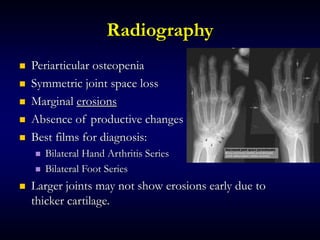 Radiography
 Periarticular osteopenia
 Symmetric joint space loss
 Marginal erosions
 Absence of productive changes
 Best films for diagnosis:
 Bilateral Hand Arthritis Series
 Bilateral Foot Series
 Larger joints may not show erosions early due to
thicker cartilage.
 
