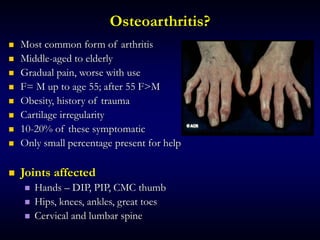 Osteoarthritis?
 Most common form of arthritis
 Middle-aged to elderly
 Gradual pain, worse with use
 F= M up to age 55; after 55 F>M
 Obesity, history of trauma
 Cartilage irregularity
 10-20% of these symptomatic
 Only small percentage present for help
 Joints affected
 Hands – DIP, PIP, CMC thumb
 Hips, knees, ankles, great toes
 Cervical and lumbar spine
 