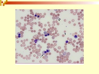627674444.inmunohematología final