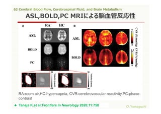 62 cerebral blood flow,cerebrospinal fluid,and brain metabolism | PDF