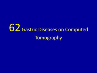 62Gastric Diseases on Computed
Tomography
 