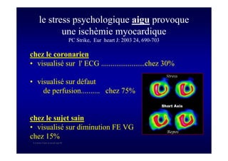 S Corone.Coeur et travail sept 08
le stress psychologique aigu provoque
une ischèmie myocardique
PC Strike, Eur heart J: 2003 24, 690-703
chez le coronarien
• visualisé sur l' ECG .......................chez 30%
• visualisé sur défaut
de perfusion.......... chez 75%
chez le sujet sain
• visualisé sur diminution FE VG
chez 15%
 