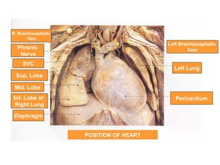 POSITION OF HEART
Pericardium
Left Lung
Left Brachiocephalic
Vein
Diaphragm
Inf. Lobe of
Right Lung
Mid. Lobe
Sup. Lobe
SVC
Phrenic
Nerve
R. Brachiocephalic
Vein
 
