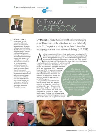 63
CASE FILES
Aesthetic Medicine • July/August 2014
I N J E C TA B L E S
www.aestheticmed.co.uk
Dr Patrick Treacy shares some of his most challenging
cases. This month, the he talks about a 71 year old socially
isolated HIV+ patient with significant facial defects after
undergoing treatment with antiretroviral drugs (HAART)
Dr Treacy’s
CASEBOOK
DR PATRICK TREACY
is chairman of the Irish
Association of Cosmetic
Doctors and Irish regional
representative of the British
College of Aesthetic Medicine
(BCAM). He is European medical
advisor to Network Lipolysis
and Consulting Rooms and
holds higher qualifications in
dermatology, laser technology
and skin resurfacing. In 2012
and 2013 he won awards for
‘Best Innovative Techniques’
for his contributions to
facial aesthetics and hair
transplants. Dr Treacy also
sits on the editorial boards
of three international
journals and features regularly
on international television and
radio programmes. He was a
faculty member at IMCAS
Paris 2013, AMWC Monaco
2013, EAMWC Moscow 2013
and a keynote speaker for
the American Academy of
Anti-Ageing Medicine in
Mexico City this year.
>>
SPONSORED BY
A
n American patient with severe facial lipodystrophy secondary to HIV-
infection was referred to the Ailesbury Clinic. He was 71 years old and had
been suffering from HIV for 17 years. He had a full hematologic evaluation,
including a full blood count, biochemistry, liver function, lipids, glucose,
lactate, viral load and CD4 cell count. The subject had a CD4 of 632/µl with
a viral load below limit of detection. He had not received
any prior treatment for their HLS. He was been
treated by thymidine analogues stavudine
(d4T) and zidovudine (ZDV, previously
known as AZT). He was not receiving
anticoagulant therapy, steroids, or anti-
infective medications. The patient was
markedly socially isolated and had not
appeared outside his apartment for a
period of four years.
The patient was injected bilaterally
into the buccal, malar, and temporal
areas of his face with 23cc of the
polyalkylimide gel (BioAlcamid®,
Polymekon, Italy) in an attempt to
replace subcutaneous fat that had
atrophied as a result of severe facial
lipodystrophy. Regional injected anesthesia
was used in conjunction with topical anesthesia.
The treated area was sculptured to obtain
The patient was
injected bilaterally into the
buccal, malar, and temporal
areas of his face with 23cc of the
polyalkylimide gel (BioAlcamid®
,
Polymekon, Italy) in an attempt to
replace subcutaneous fat that had
atrophied as a result of severe
facial lipodystrophy
 