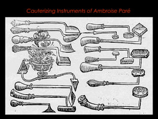 Cauterizing Instruments of Ambroise Paré 
 