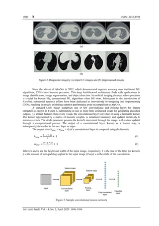 Hybrid model detection and classification of lung cancer | PDF