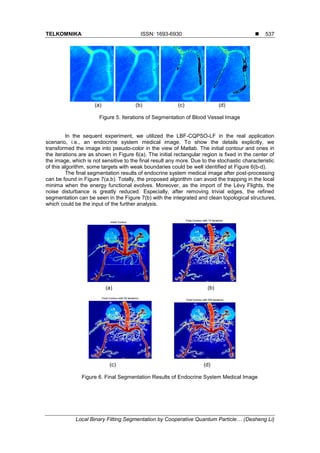 TELKOMNIKA ISSN: 1693-6930 
Local Binary Fitting Segmentation by Cooperative Quantum Particle… (Desheng Li)
537
(a) (b) (c) (d)
Figure 5. Iterations of Segmentation of Blood Vessel Image
In the sequent experiment, we utilized the LBF-CQPSO-LF in the real application
scenario, i.e., an endocrine system medical image. To show the details explicitly, we
transformed the image into pseudo-color in the view of Matlab. The initial contour and ones in
the iterations are as shown in Figure 6(a). The initial rectangular region is fixed in the center of
the image, which is not sensitive to the final result any more. Due to the stochastic characteristic
of this algorithm, some targets with weak boundaries could be well identified at Figure 6(b-d).
The final segmentation results of endocrine system medical image after post-processing
can be found in Figure 7(a,b). Totally, the proposed algorithm can avoid the trapping in the local
minima when the energy functional evolves. Moreover, as the import of the Lévy Flights, the
noise disturbance is greatly reduced. Especially, after removing trivial edges, the refined
segmentation can be seen in the Figure 7(b) with the integrated and clean topological structures,
which could be the input of the further analysis.
(a) (b)
(c) (d)
Figure 6. Final Segmentation Results of Endocrine System Medical Image
 