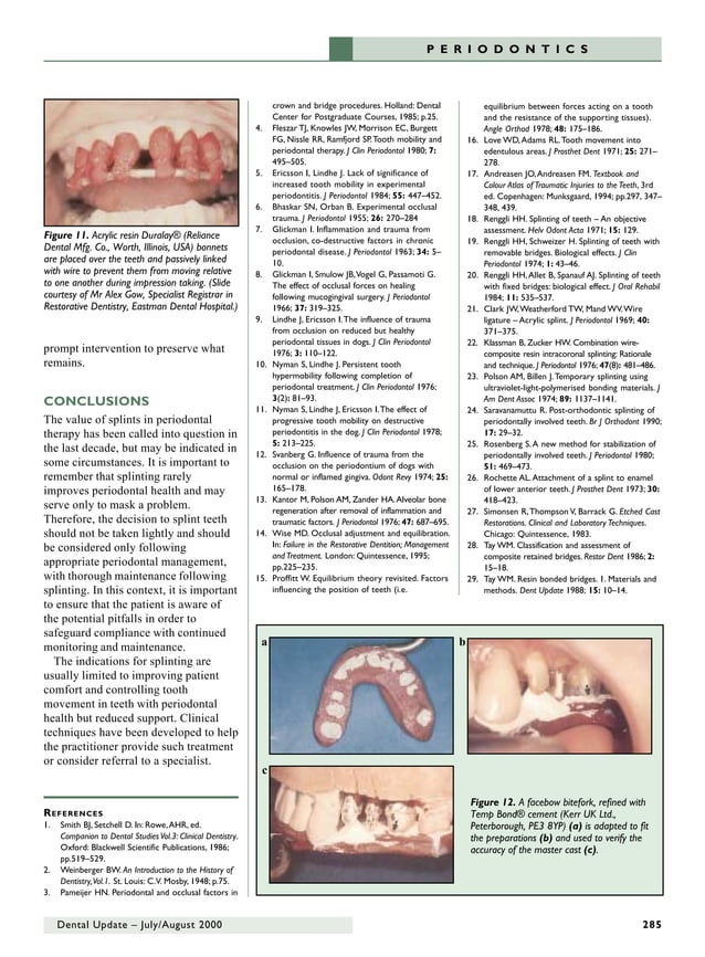 63668245 dental-update-periodontal-splinting-in-general-dental-practice ...