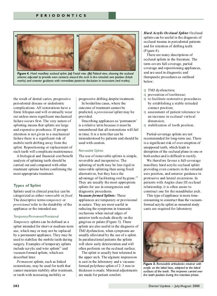 63668245 dentalupdateperiodontalsplintingingeneraldentalpracti…