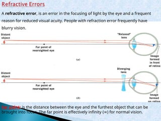 Comprehensive Physics of the Human Eye and Vision Systems | PPT