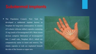 Norplant R2 646310691-Family-Planning-methods-Contraceptive-methods-Nurses ...