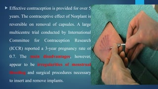 Norplant R2 646310691-Family-Planning-methods-Contraceptive-methods-Nurses ...