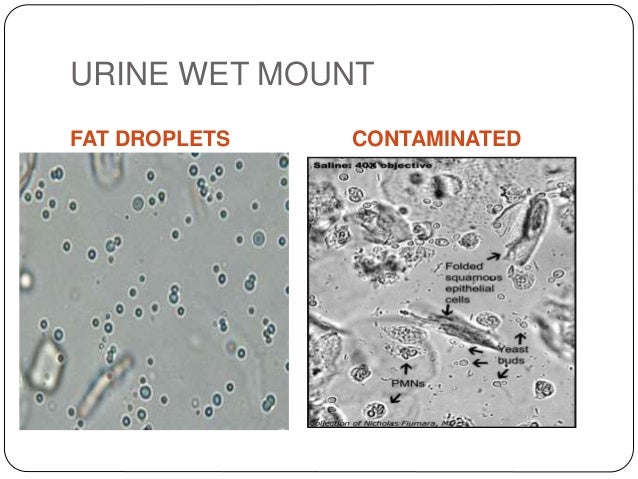 DIRECT MICROSCOPY PPT 1