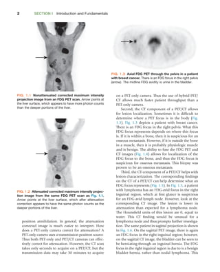 Fundamentals of Oncologic PET/CT Gary Ulaner | PDF