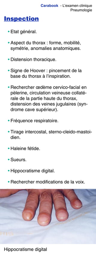 Carabook - L’examen clinique
Pneumologie
Inspection
• Etat général.
• Aspect du thorax : forme, mobilité,
symétrie, anomalies anatomiques.
• Distension thoracique.
• Signe de Hoover : pincement de la
base du thorax à l’inspiration.
• Rechercher œdème cervico-facial en
pèlerine, circulation veineuse collaté-
rale de la partie haute du thorax,
distension des veines jugulaires (syn-
drome cave supérieur).
• Fréquence respiratoire.
• Tirage intercostal, sterno-cleido-mastoi-
dien.
• Haleine fétide.
• Sueurs.
• Hippocratisme digital.
• Rechercher modifications de la voix.
Hippocratisme digital
 