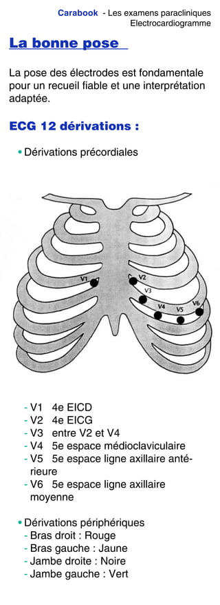 Carabook - Les examens paracliniques
Electrocardiogramme
La bonne pose
La pose des électrodes est fondamentale
pour un recueil fiable et une interprétation
adaptée.
ECG 12 dérivations :
• Dérivations précordiales
- V1 4e EICD
- V2 4e EICG
- V3 entre V2 et V4
- V4 5e espace médioclaviculaire
- V5 5e espace ligne axillaire anté-
rieure
- V6 5e espace ligne axillaire
moyenne
• Dérivations périphériques
- Bras droit : Rouge
- Bras gauche : Jaune
- Jambe droite : Noire
- Jambe gauche : Vert
 