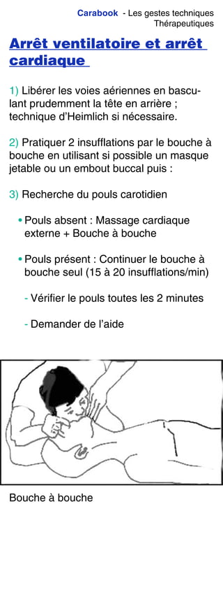 Carabook - Les gestes techniques
Thérapeutiques
Arrêt ventilatoire et arrêt
cardiaque
1) Libérer les voies aériennes en bascu-
lant prudemment la tête en arrière ;
technique d’Heimlich si nécessaire.
2) Pratiquer 2 insufflations par le bouche à
bouche en utilisant si possible un masque
jetable ou un embout buccal puis :
3) Recherche du pouls carotidien
• Pouls absent : Massage cardiaque
externe + Bouche à bouche
• Pouls présent : Continuer le bouche à
bouche seul (15 à 20 insufflations/min)
- Vérifier le pouls toutes les 2 minutes
- Demander de l’aide
Bouche à bouche
 