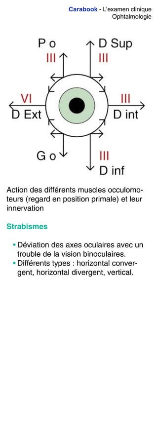 Carabook - L’examen clinique
Ophtalmologie
Action des différents muscles occulomo-
teurs (regard en position primale) et leur
innervation
Strabismes
• Déviation des axes oculaires avec un
trouble de la vision binoculaires.
• Différents types : horizontal conver-
gent, horizontal divergent, vertical.
 