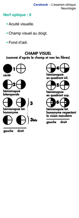 Carabook - L’examen clinique
Neurologie
Nerf optique : II
• Acuité visuelle.
• Champ visuel au doigt.
• Fond d’œil.
 