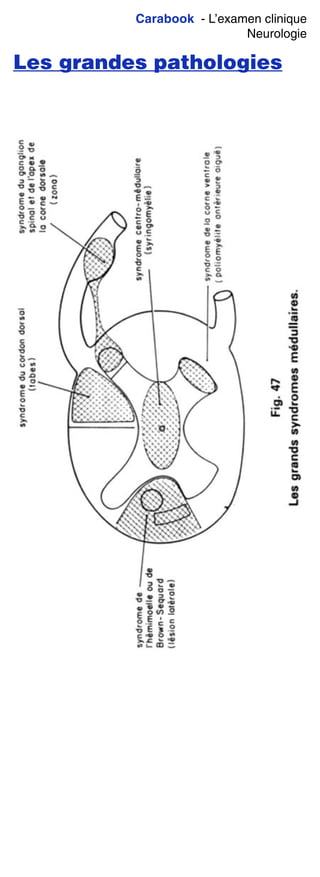 Carabook - L’examen clinique
Neurologie
Les grandes pathologies
 