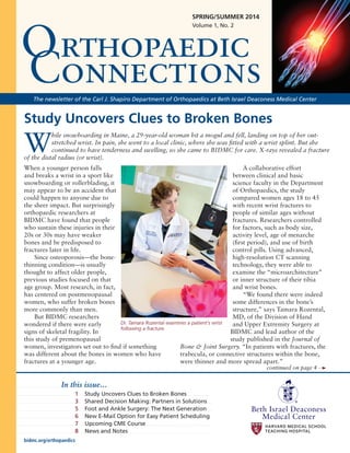 Brown Fat May Lead to Obesity Treatment
< home >
bidmc.org/orthopaedics
SPRING/SUMMER 2014
Volume 1, No. 2
Study Uncovers Clues to Broken Bones
W
hile snowboarding in Maine, a 29-year-old woman hit a mogul and fell, landing on top of her out-
stretched wrist. In pain, she went to a local clinic, where she was fitted with a wrist splint. But she
continued to have tenderness and swelling, so she came to BIDMC for care. X-rays revealed a fracture
of the distal radius (or wrist).
When a younger person falls
and breaks a wrist in a sport like
snowboarding or rollerblading, it
may appear to be an accident that
could happen to anyone due to
the sheer impact. But surprisingly
orthopaedic researchers at
BIDMC have found that people
who sustain these injuries in their
20s or 30s may have weaker
bones and be predisposed to
fractures later in life.
Since osteoporosis—the bone-
thinning condition—is usually
thought to affect older people,
previous studies focused on that
age group. Most research, in fact,
has centered on postmenopausal
women, who suffer broken bones
more commonly than men.
But BIDMC researchers
wondered if there were early
signs of skeletal fragility. In
this study of premenopausal
women, investigators set out to find if something
was different about the bones in women who have
fractures at a younger age.
A collaborative effort
between clinical and basic
science faculty in the Department
of Orthopaedics, the study
compared women ages 18 to 45
with recent wrist fractures to
people of similar ages without
fractures. Researchers controlled
for factors, such as body size,
activity level, age of menarche
(first period), and use of birth
control pills. Using advanced,
high-resolution CT scanning
technology, they were able to
examine the “microarchitecture”
or inner structure of their tibia
and wrist bones.
“We found there were indeed
some differences in the bone’s
structure,” says Tamara Rozental,
MD, of the Division of Hand
and Upper Extremity Surgery at
BIDMC and lead author of the
study published in the Journal of
Bone & Joint Surgery. “In patients with fractures, the
trabecula, or connective structures within the bone,
were thinner and more spread apart.”
Orthopaedic
Connections
continued on page 4
In this issue…
1 	 Study Uncovers Clues to Broken Bones	
3 	 Shared Decision Making: Partners in Solutions
5 	 Foot and Ankle Surgery: The Next Generation
6 	 New E-Mail Option for Easy Patient Scheduling
7 	 Upcoming CME Course
8 	 News and Notes
The newsletter of the Carl J. Shapiro Department of Orthopaedics at Beth Israel Deaconess Medical Center
Dr. Tamara Rozental examines a patient’s wrist
following a fracture.
 