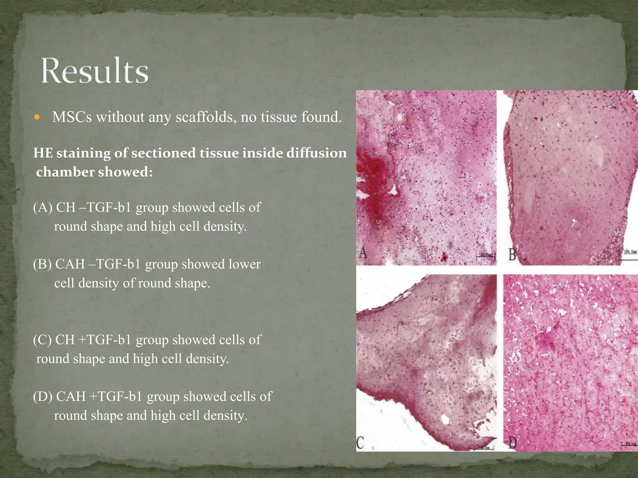  MSCs without any scaffolds, no tissue found.

HE staining of sectioned tissue inside diffusion
chamber showed:

(A) CH –TGF-b1 group showed cells of
   round shape and high cell density.

(B) CAH –TGF-b1 group showed lower
    cell density of round shape.



(C) CH +TGF-b1 group showed cells of
 round shape and high cell density.

(D) CAH +TGF-b1 group showed cells of
   round shape and high cell density.
 