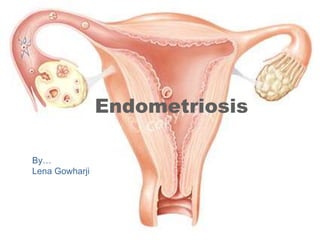 Endometriosis
By…
Lena Gowharji
 