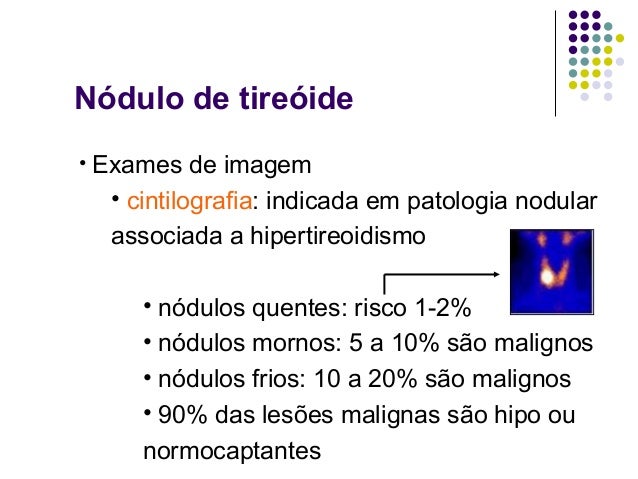 Exame de cintilografia da tireoide