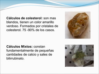 Cálculos de colesterol: son mas
blandos, tienen un color amarillo
verdoso. Formados por cristales de
colesterol. 75 -90% de los casos.
Cálculos Mixtos: constan
fundamentalmente de pequeñas
cantidades de calcio y sales de
bilirrubinato.
 