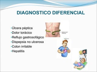 DIAGNOSTICO DIFERENCIAL
•Úlcera péptica
•Dolor torácico
•Reflujo gastrosofágico
•Dispepsia no ulcerosa
•Colon irritable
•Hepatitis
 