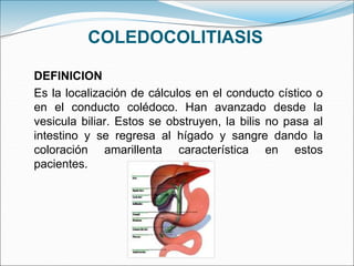 COLEDOCOLITIASIS
DEFINICION
Es la localización de cálculos en el conducto cístico o
en el conducto colédoco. Han avanzado desde la
vesicula biliar. Estos se obstruyen, la bilis no pasa al
intestino y se regresa al hígado y sangre dando la
coloración amarillenta característica en estos
pacientes.
 