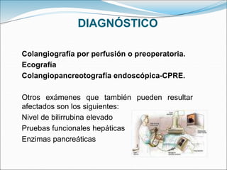 DIAGNÓSTICO
Colangiografía por perfusión o preoperatoria.
Ecografía
Colangiopancreotografía endoscópica-CPRE.
Otros exámenes que también pueden resultar
afectados son los siguientes:
Nivel de bilirrubina elevado
Pruebas funcionales hepáticas
Enzimas pancreáticas
 
