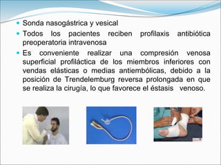  Sonda nasogástrica y vesical
 Todos los pacientes reciben profilaxis antibiótica
preoperatoria intravenosa
 Es conveniente realizar una compresión venosa
superficial profiláctica de los miembros inferiores con
vendas elásticas o medias antiembólicas, debido a la
posición de Trendelemburg reversa prolongada en que
se realiza la cirugía, lo que favorece el éstasis venoso.
 