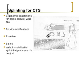 656300617-Splinting-for-Peripheral-Nerve-Injuries-PPT-2023.ppt