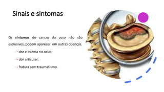 Sinais e sintomas
Os sintomas de cancro do osso não são
exclusivos, podem aparecer em outras doenças.
⇢ dor e edema no osso;
⇢ dor articular;
⇢ fratura sem traumatismo.
 