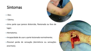 Sintomas
→ Dor;
→ Edema;
→Uma parte que parece distorcida, flexionada ou fora de
lugar;
→Hematoma;
→Incapacidade de usar a parte lesionada normalmente;
→Possível perda de sensação (dormência ou sensações
anormais).
 