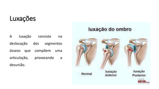 Luxações
A luxação consiste na
deslocação dos segmentos
ósseos que compõem uma
articulação, provocando a
desunião.
 