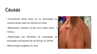 Causas
→ Traumatismo direto (osso ou na articulação) ou
indireto (queda sobre um cotovelo ou mão);
→ Movimentos violentos ou por uma tração súbita e
intensa;
→ Deterioração dos elementos de sustentação da
articulação, consequente de um doença. Ex: Artrite
→Mal formação congénita. Ex: anca
 