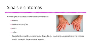 Sinais e sintomas
A inflamação articular causa alterações características:
→edema,
→dor das articulações
→rubor
→ calor.
→Causa também rigidez, uma sensação de prisão dos movimentos, especialmente no início da
manhã ou depois de períodos de repouso.
 