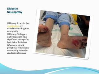 Diabetic
Neuropathy
History & careful foot
examination are
mandatory to diagnose
neuropathy
Up to 50%of type2
diabetic patient have
significant neuropathy
& at risk of foot ulcer
Sensorimotor &
peripheral sympathatic
neuropathy are major
risk factors for ulcer
 