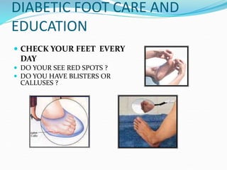 DIABETIC FOOT CARE AND
EDUCATION
 CHECK YOUR FEET EVERY
DAY
 DO YOUR SEE RED SPOTS ?
 DO YOU HAVE BLISTERS OR
CALLUSES ?
 