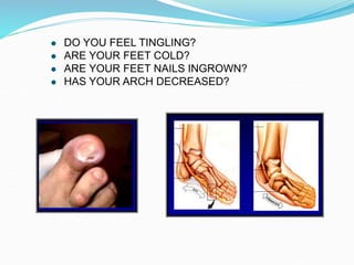  DO YOU FEEL TINGLING?
 ARE YOUR FEET COLD?
 ARE YOUR FEET NAILS INGROWN?
 HAS YOUR ARCH DECREASED?
 