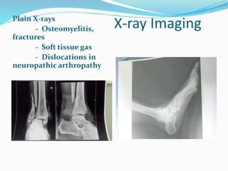 X-ray Imaging
Plain X-rays
- Osteomyelitis,
fractures
- Soft tissue gas
- Dislocations in
neuropathic arthropathy
 