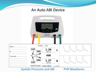 An Auto ABI Device
Systolic Pressures and ABI PVR Waveforms
 