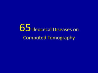 65Ileocecal Diseases on
Computed Tomography
 