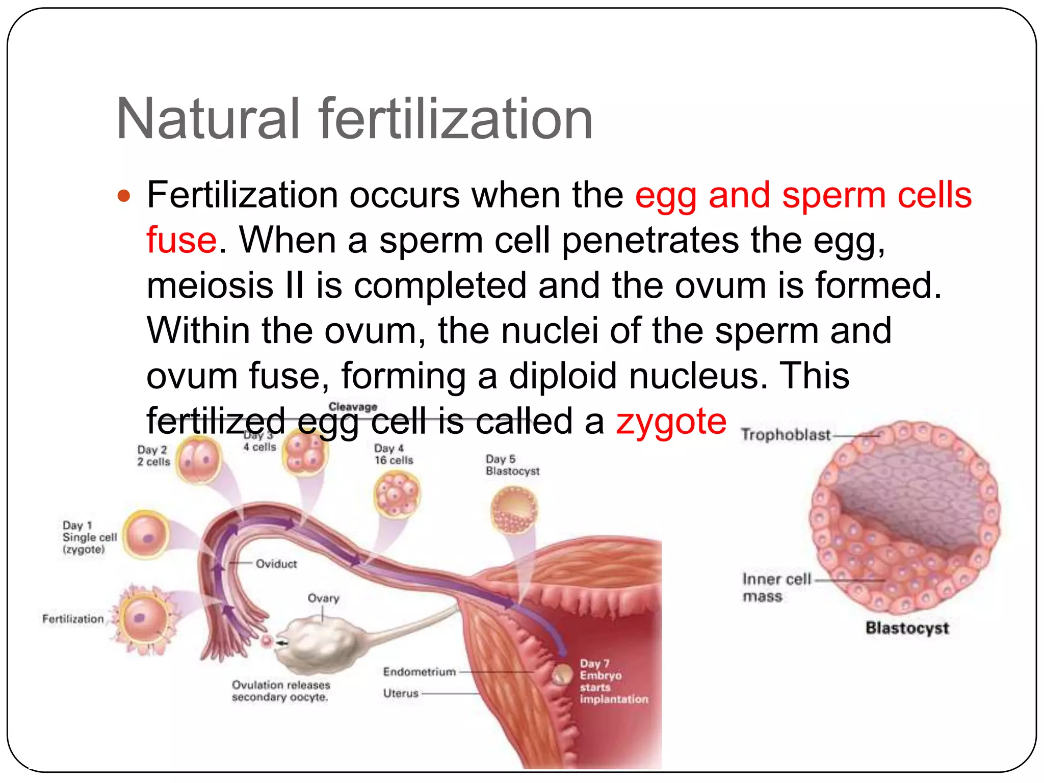 Natural fertilization
 Fertilization occurs when the egg and sperm cells
 fuse. When a sperm cell penetrates the egg,
 meiosis II is completed and the ovum is formed.
 Within the ovum, the nuclei of the sperm and
 ovum fuse, forming a diploid nucleus. This
 fertilized egg cell is called a zygote.
 