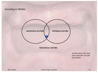 Mechical Ridge 660365804-Residual-ridge-resorption-seminar-PART-2.pptx