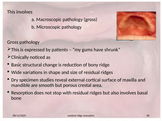 660365804-Residual-ridge-resorption-seminar-PART-2.pptx